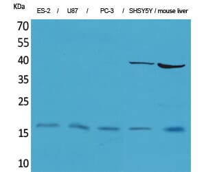 Western Blot analysis of ES-2 U87 PC-3 SHSY5Y mouse liver cells using IL-1&#946; Polyclonal Antibody