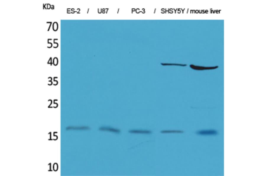 Western blot - IL-1β Polyclonal Antibody from Signalway Antibody (41610) - Antibodies.com