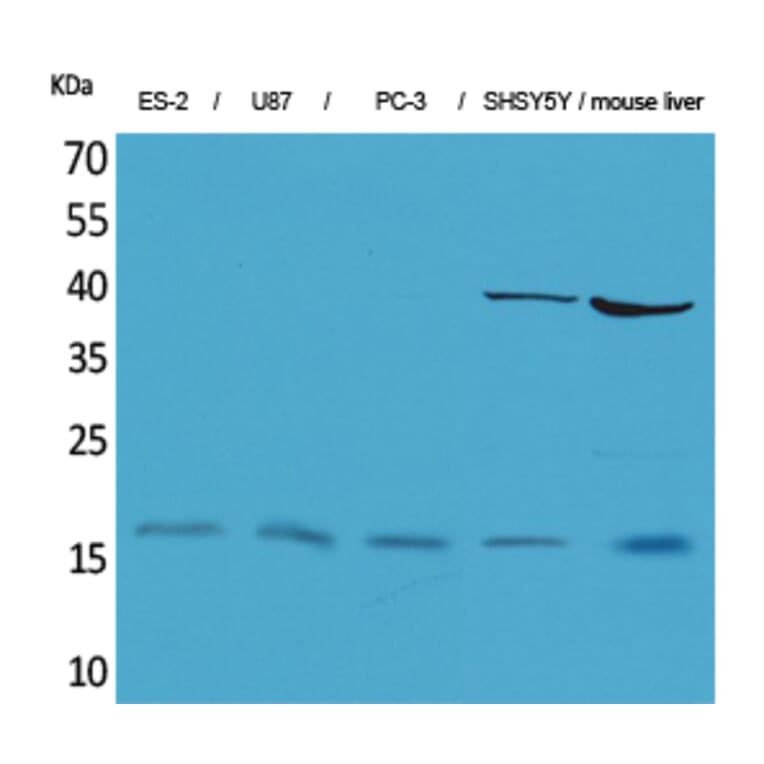 Western blot - IL-1β Polyclonal Antibody from Signalway Antibody (41610) - Antibodies.com