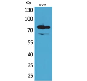 Western blot - FOXP1 Polyclonal Antibody from Signalway Antibody (41621) - Antibodies.com