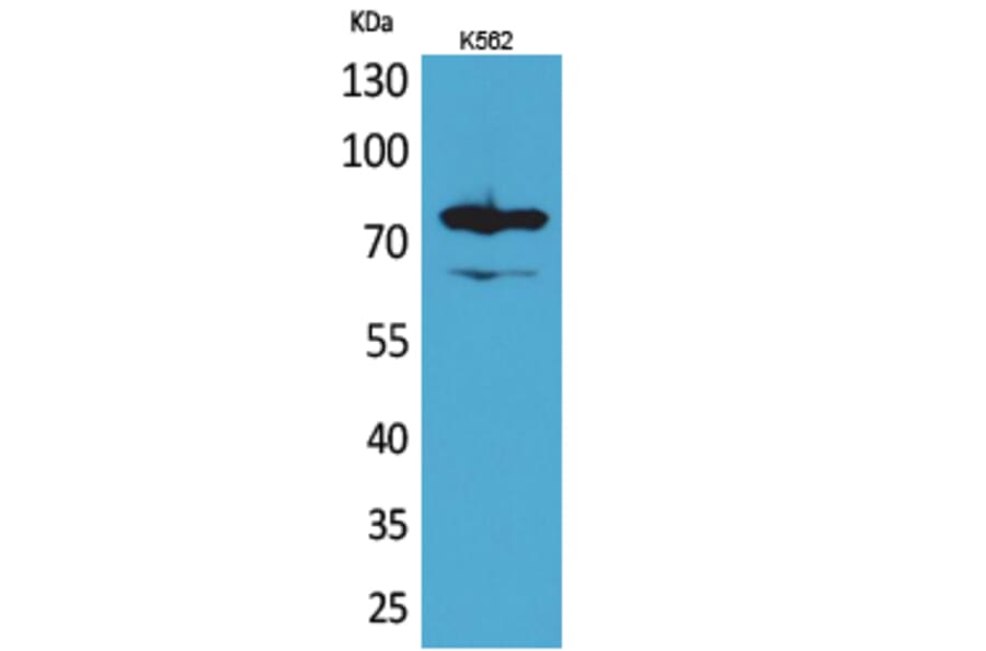 Western blot - FOXP1 Polyclonal Antibody from Signalway Antibody (41621) - Antibodies.com