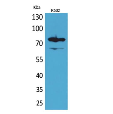 Western blot - FOXP1 Polyclonal Antibody from Signalway Antibody (41621) - Antibodies.com
