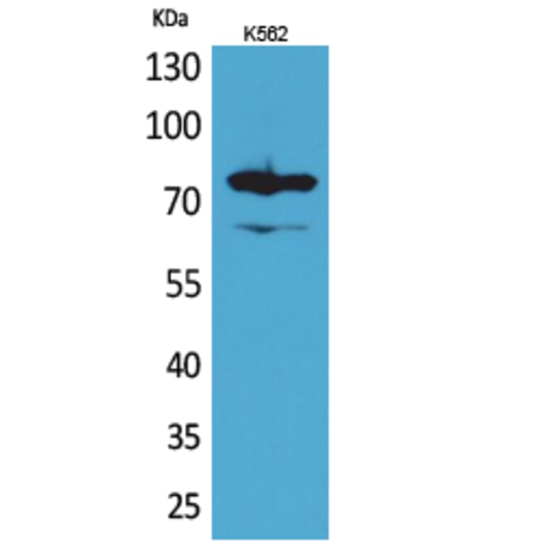 Western blot - FOXP1 Polyclonal Antibody from Signalway Antibody (41621) - Antibodies.com