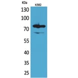 Western blot - FOXP1 Polyclonal Antibody from Signalway Antibody (41621) - Antibodies.com