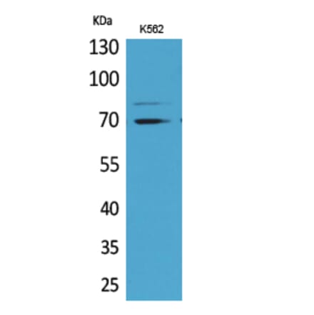 Western blot - Keap1 Polyclonal Antibody from Signalway Antibody (41626) - Antibodies.com