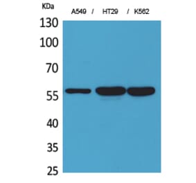 Western blot - ERp57 Polyclonal Antibody from Signalway Antibody (41628) - Antibodies.com