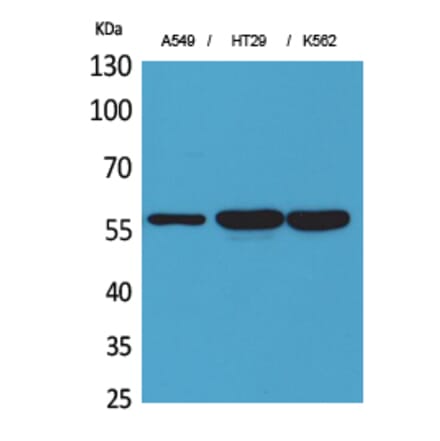 Western blot - ERp57 Polyclonal Antibody from Signalway Antibody (41628) - Antibodies.com