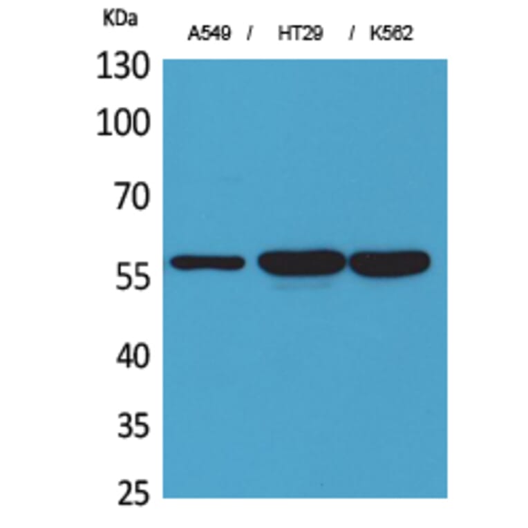 Western blot - ERp57 Polyclonal Antibody from Signalway Antibody (41628) - Antibodies.com