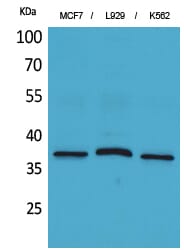 Western Blot analysis of MCF7 L929 K562 cells using CD79b Polyclonal Antibody