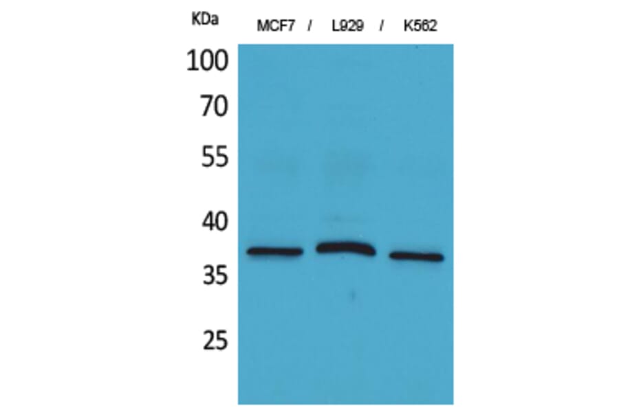 Western blot - CD79b Polyclonal Antibody from Signalway Antibody (41662) - Antibodies.com
