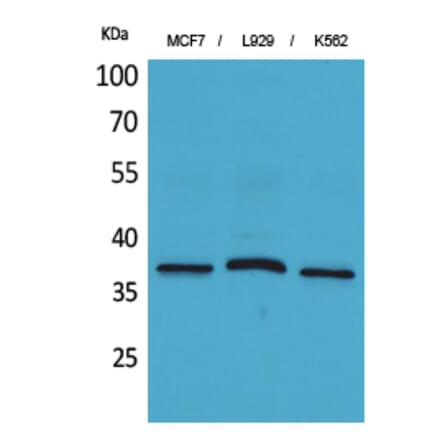 Western blot - CD79b Polyclonal Antibody from Signalway Antibody (41662) - Antibodies.com