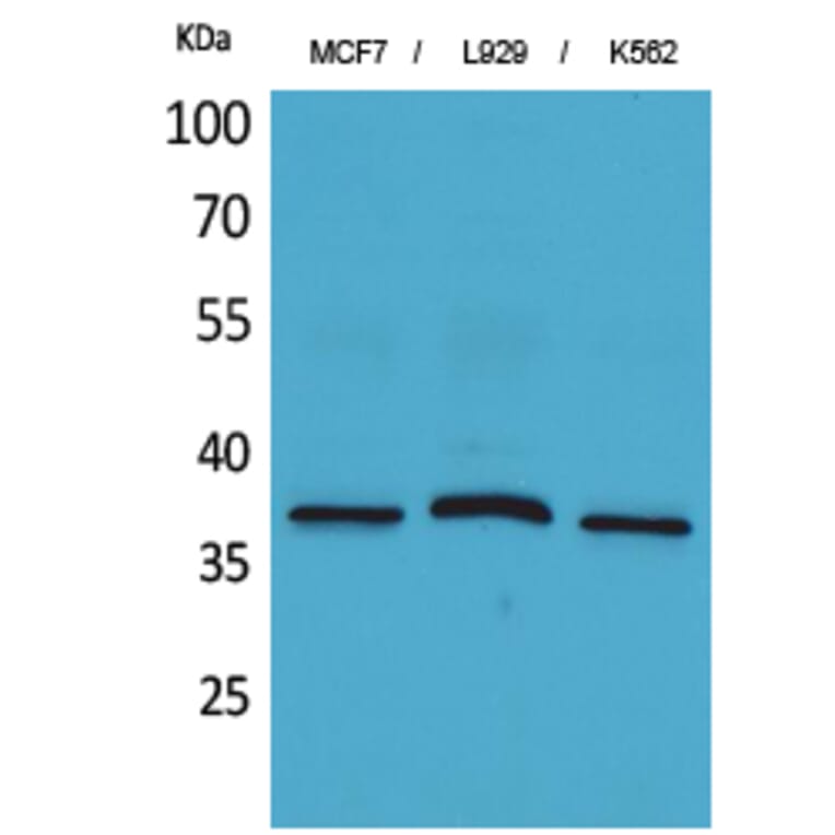 Western blot - CD79b Polyclonal Antibody from Signalway Antibody (41662) - Antibodies.com