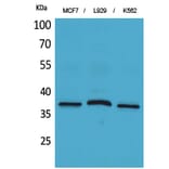 Western blot - CD79b Polyclonal Antibody from Signalway Antibody (41662) - Antibodies.com