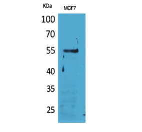 Western blot - CD85g Polyclonal Antibody from Signalway Antibody (41665) - Antibodies.com