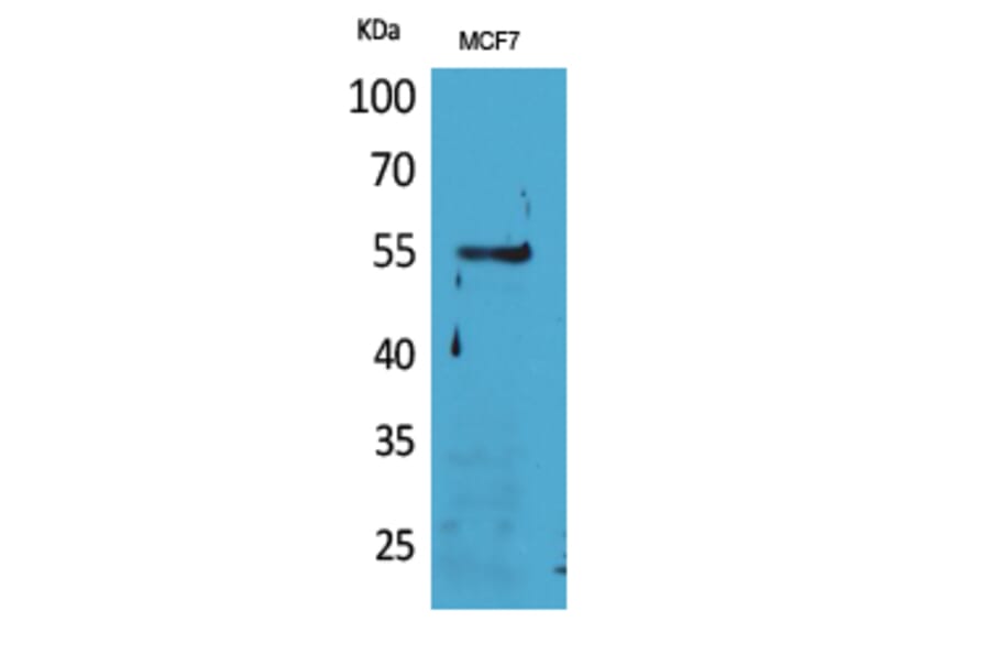 Western blot - CD85g Polyclonal Antibody from Signalway Antibody (41665) - Antibodies.com