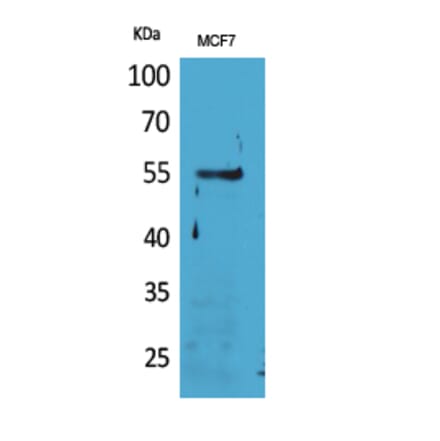 Western blot - CD85g Polyclonal Antibody from Signalway Antibody (41665) - Antibodies.com