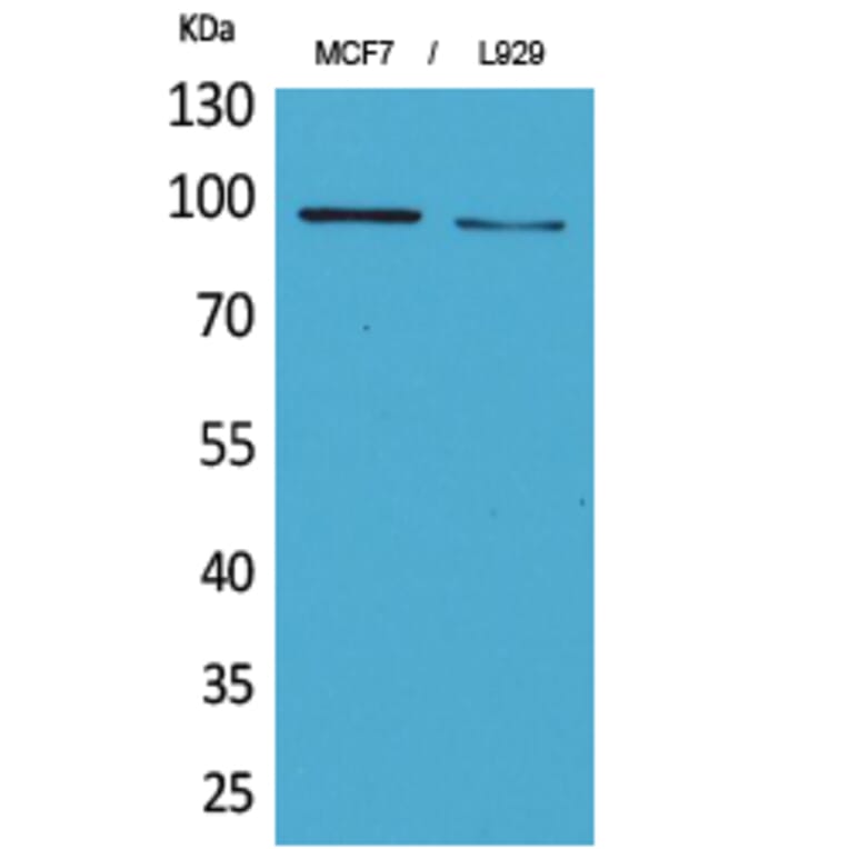 Western blot - CD100 Polyclonal Antibody from Signalway Antibody (41666) - Antibodies.com