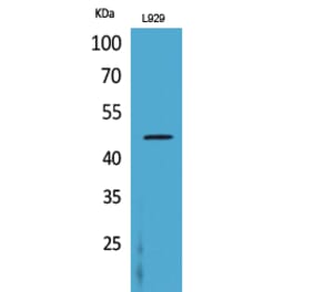 Western blot - CD116 Polyclonal Antibody from Signalway Antibody (41669) - Antibodies.com