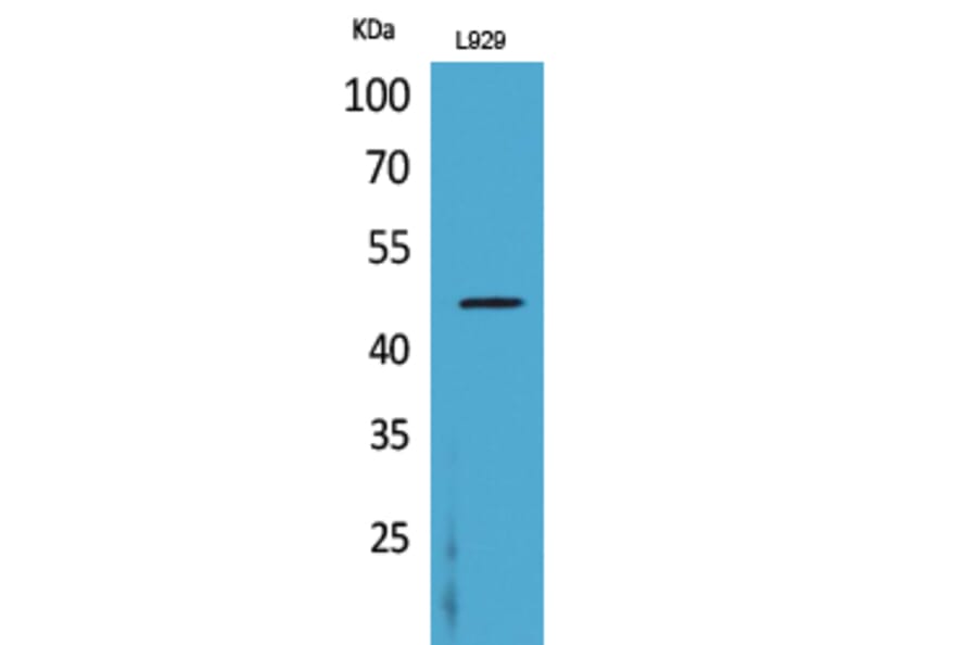 Western blot - CD116 Polyclonal Antibody from Signalway Antibody (41669) - Antibodies.com