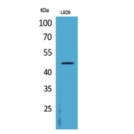 Western blot - CD116 Polyclonal Antibody from Signalway Antibody (41669) - Antibodies.com