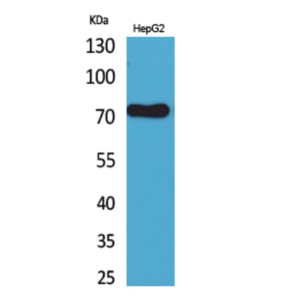 Western blot - CD229 Polyclonal Antibody from Signalway Antibody (41678) - Antibodies.com