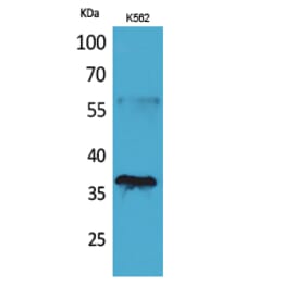 Western blot - CD207 Polyclonal Antibody from Signalway Antibody (41681) - Antibodies.com