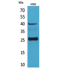 Western blot - CD161 Polyclonal Antibody from Signalway Antibody (41682) - Antibodies.com