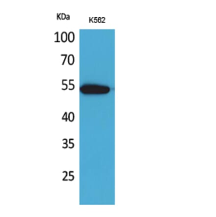 Western blot - CD329 Polyclonal Antibody from Signalway Antibody (41684) - Antibodies.com