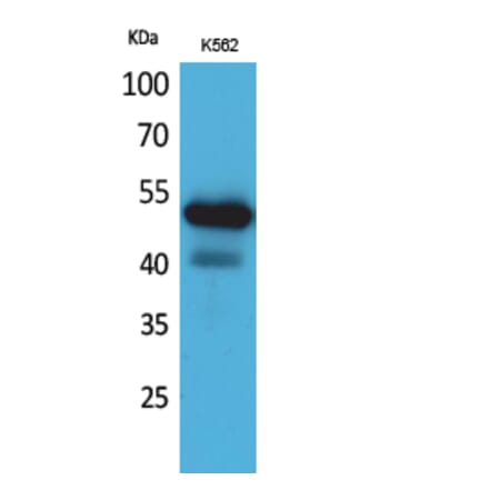 Western blot - CD328 Polyclonal Antibody from Signalway Antibody (41687) - Antibodies.com