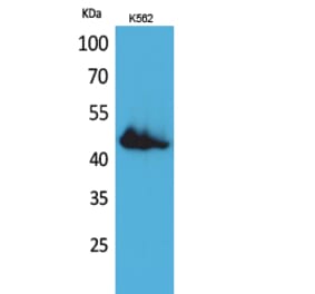 Western blot - CD177 Polyclonal Antibody from Signalway Antibody (41689) - Antibodies.com