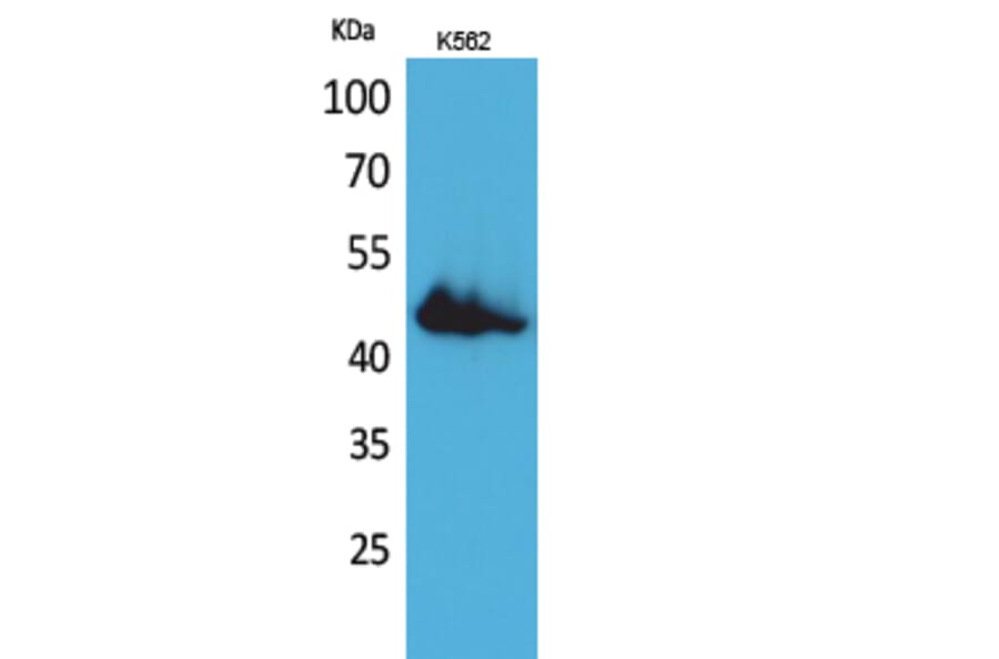 Western blot - CD177 Polyclonal Antibody from Signalway Antibody (41689) - Antibodies.com