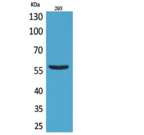 Western blot - CD276 Polyclonal Antibody from Signalway Antibody (41691) - Antibodies.com