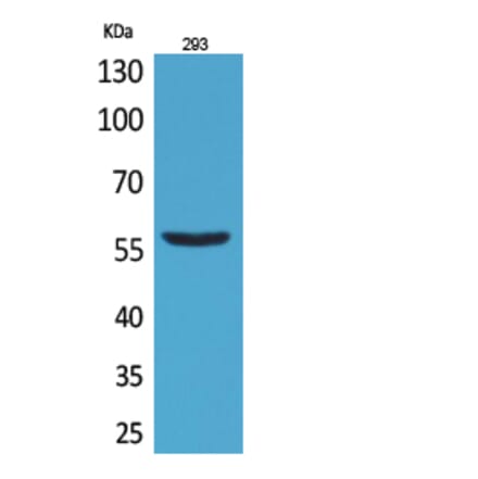 Western blot - CD276 Polyclonal Antibody from Signalway Antibody (41691) - Antibodies.com
