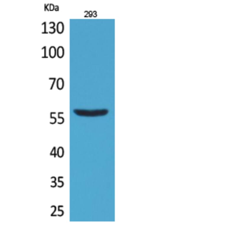 Western blot - CD276 Polyclonal Antibody from Signalway Antibody (41691) - Antibodies.com