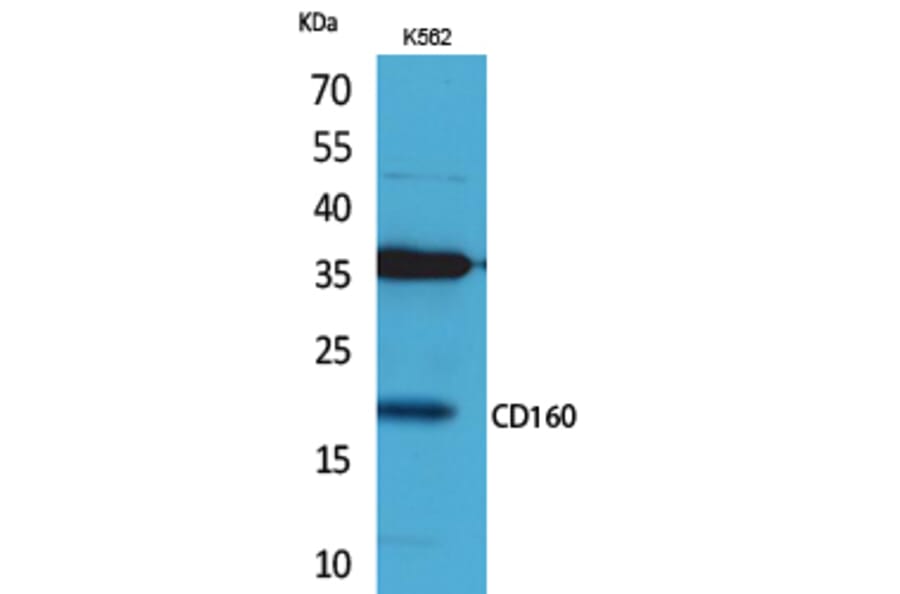 Western blot - CD160 Polyclonal Antibody from Signalway Antibody (41692) - Antibodies.com