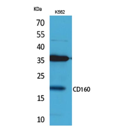 Western blot - CD160 Polyclonal Antibody from Signalway Antibody (41692) - Antibodies.com