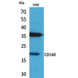 Western blot - CD160 Polyclonal Antibody from Signalway Antibody (41692) - Antibodies.com