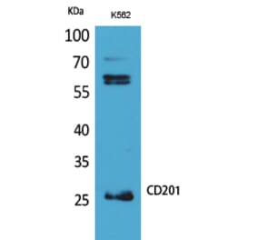 Western blot - CD201 Polyclonal Antibody from Signalway Antibody (41693) - Antibodies.com