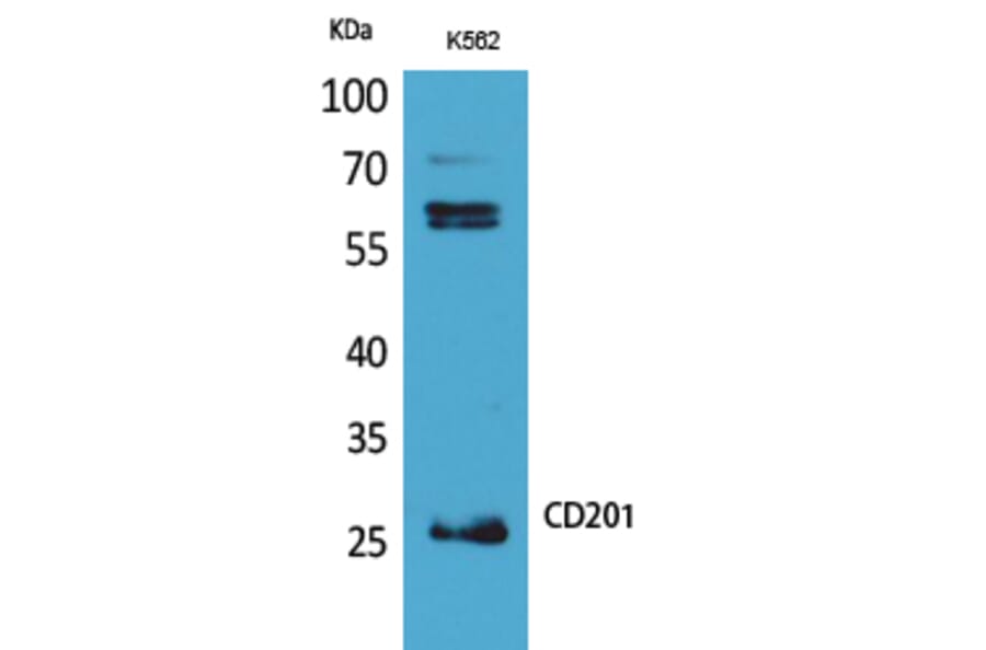 Western blot - CD201 Polyclonal Antibody from Signalway Antibody (41693) - Antibodies.com
