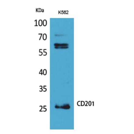 Western blot - CD201 Polyclonal Antibody from Signalway Antibody (41693) - Antibodies.com