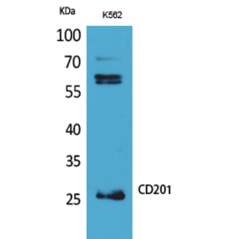Western blot - CD201 Polyclonal Antibody from Signalway Antibody (41693) - Antibodies.com