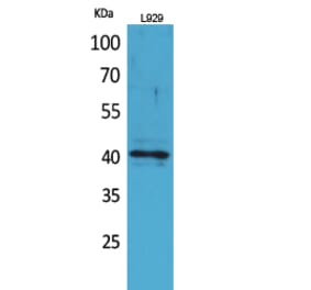 Western blot - CKR-3 Polyclonal Antibody from Signalway Antibody (41695) - Antibodies.com