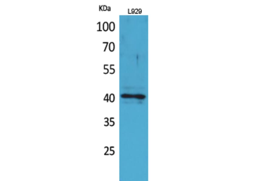 Western blot - CKR-3 Polyclonal Antibody from Signalway Antibody (41695) - Antibodies.com