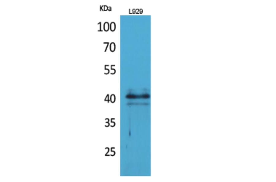 Western blot - CKR-4 Polyclonal Antibody from Signalway Antibody (41696) - Antibodies.com