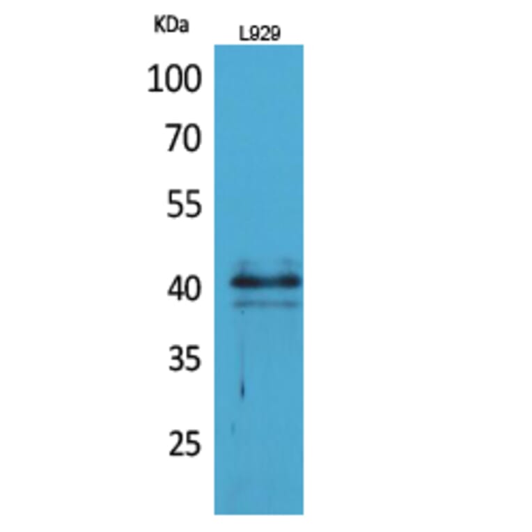 Western blot - CKR-4 Polyclonal Antibody from Signalway Antibody (41696) - Antibodies.com