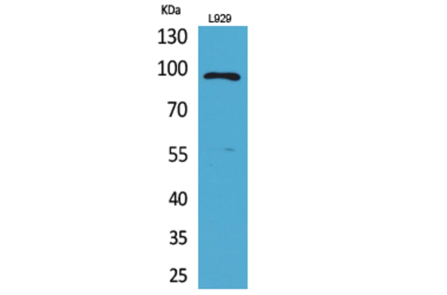 Western blot - MACC1 Polyclonal Antibody from Signalway Antibody (41698) - Antibodies.com