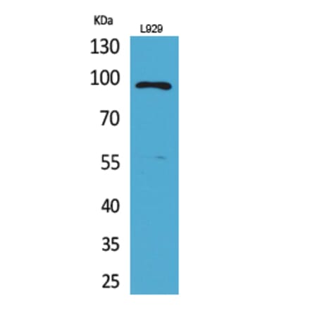Western blot - MACC1 Polyclonal Antibody from Signalway Antibody (41698) - Antibodies.com