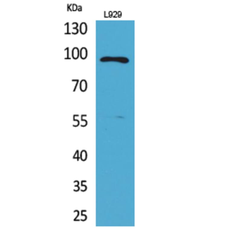 Western blot - MACC1 Polyclonal Antibody from Signalway Antibody (41698) - Antibodies.com