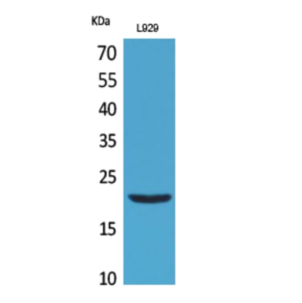 Western blot - IL-29 Polyclonal Antibody from Signalway Antibody (41703) - Antibodies.com