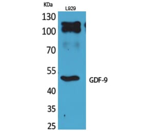 Western blot - GDF-9 Polyclonal Antibody from Signalway Antibody (41706) - Antibodies.com